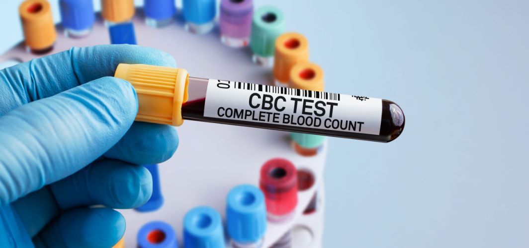 a-complete-blood-count-test-can-indicate-cancer